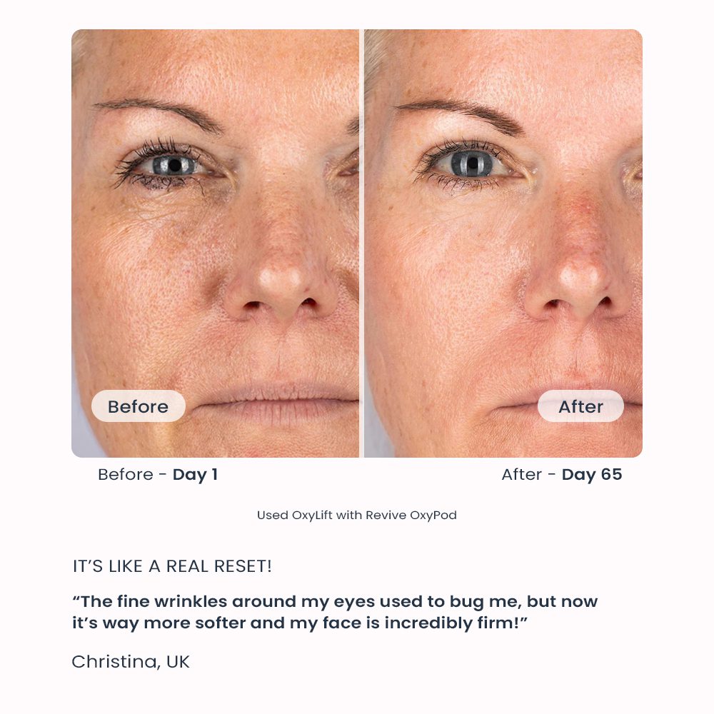 oarno oxylift christina testimonial gallery 1