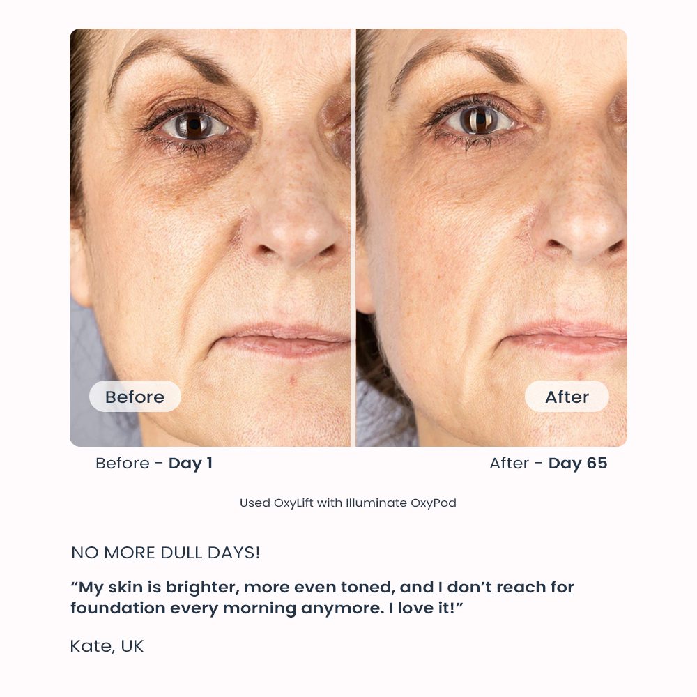 oarno oxylift kate testimonial gallery 1