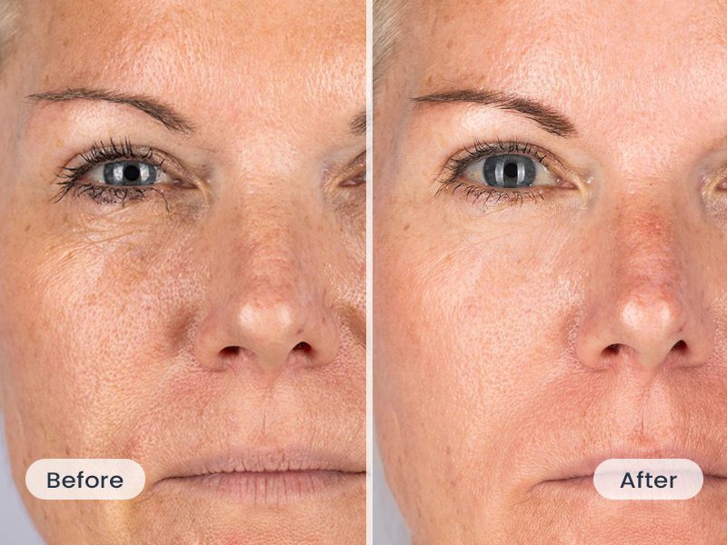 oarno oxylift testimonial christina