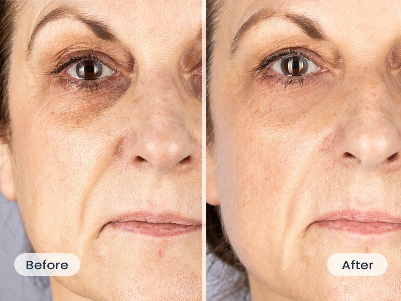 oarno oxylift testimonial kate